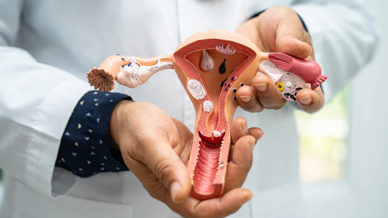 her 10 kadindan 1i risk altinda polikistik over sendromu belirtilerine dikkat IGB4qRqW