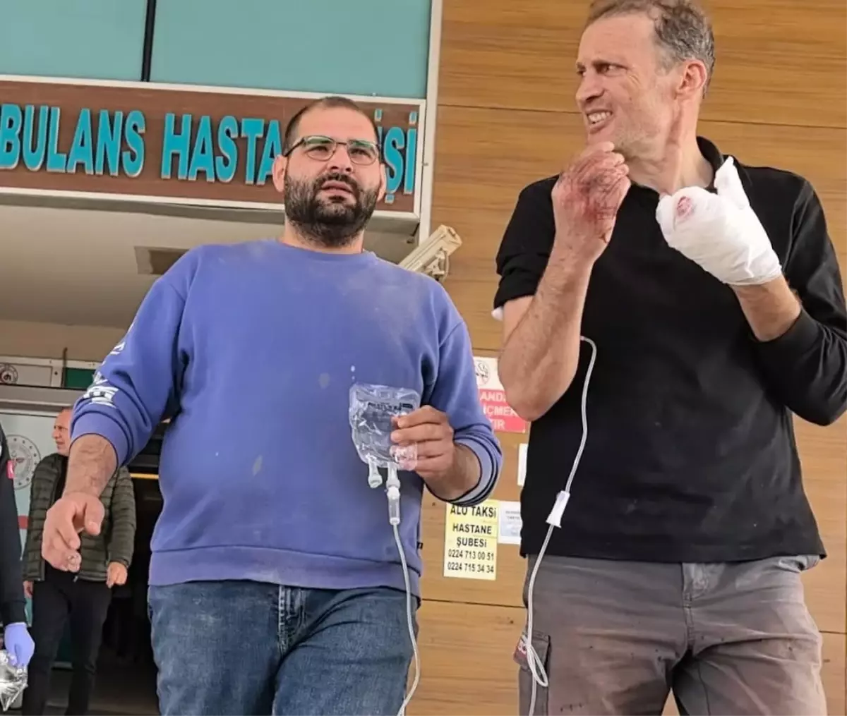 freze makinesine kaptirdigi elinden iki parmak koptu MSZZzRFp.jpg